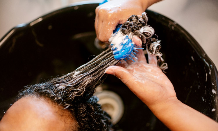 DT Tress talk| Can dandruff be treated at home without consulting a doctor? DT Tress talk| Can dandruff be treated at home without consulting a doctor?