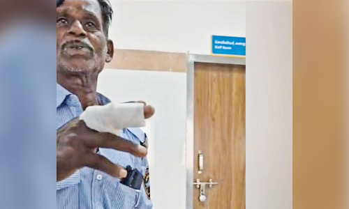 Attendant bites hospital guards finger during quarrel in Tambaram