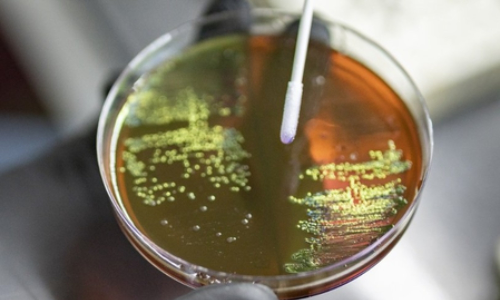 Early action on AMR key to ensure infections remain treatable, surgeries stay safe: WHO Early action on AMR key to ensure infections remain treatable, surgeries stay safe: WHO