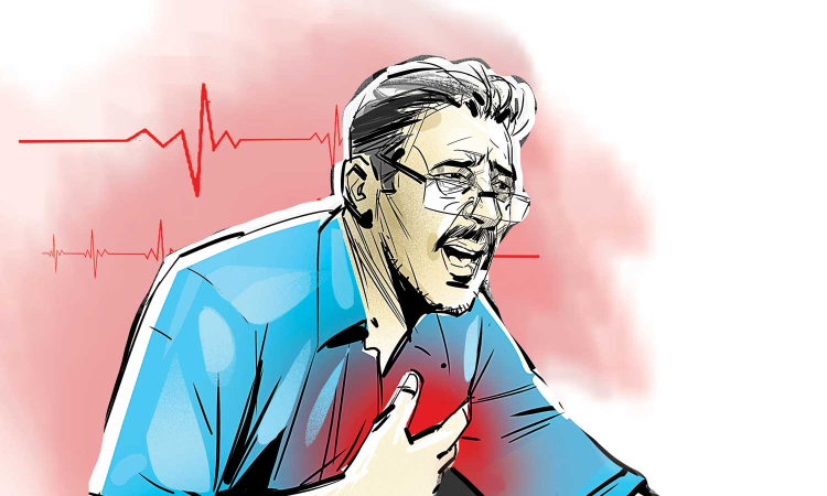 COVID behind many broken hearts: Chennai hospital study finds Coronary Artery Ectasia on rise COVID behind many broken hearts: Chennai hospital study finds Coronary Artery Ectasia on rise