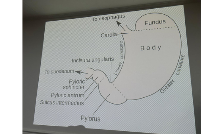 Metabolic surgery can help prevent organ damage, failure due to uncontrolled diabetes: AIIMS doctor Metabolic surgery can help prevent organ damage, failure due to uncontrolled diabetes: AIIMS doctor