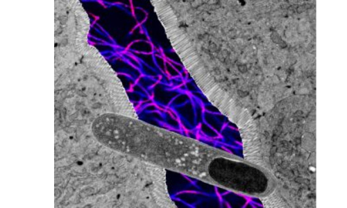 US researchers find gut bacteria that can help lose weight, boost metabolic health US researchers find gut bacteria that can help lose weight, boost metabolic health