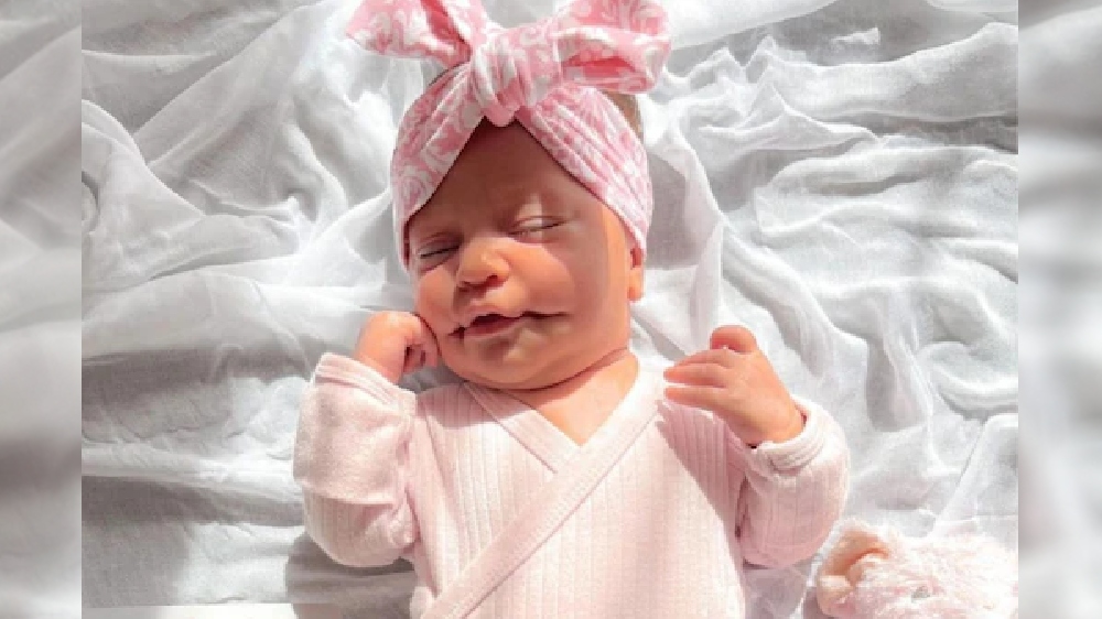 Baby born with ‘permanent smile’ brings smile on million others Baby born with ‘permanent smile’ brings smile on million others