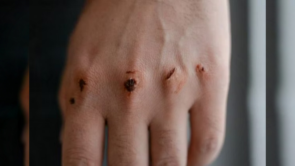 Research suggests minerals might be key to healing damaged tissue