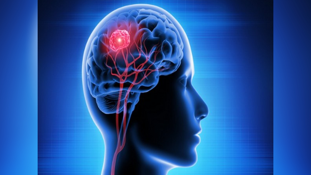Study provides new insight into brain complexity