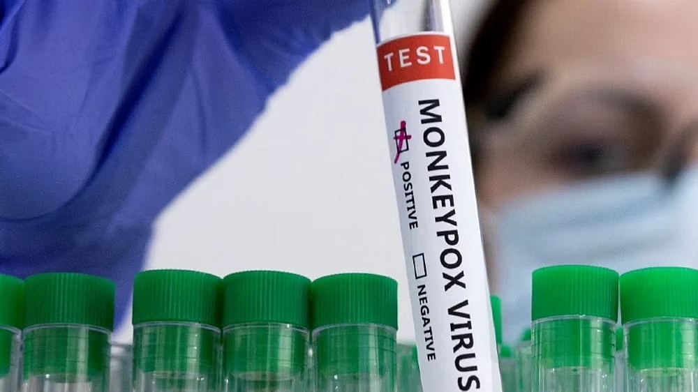 Suspected monkeypox case: Youth under observation in Kerala