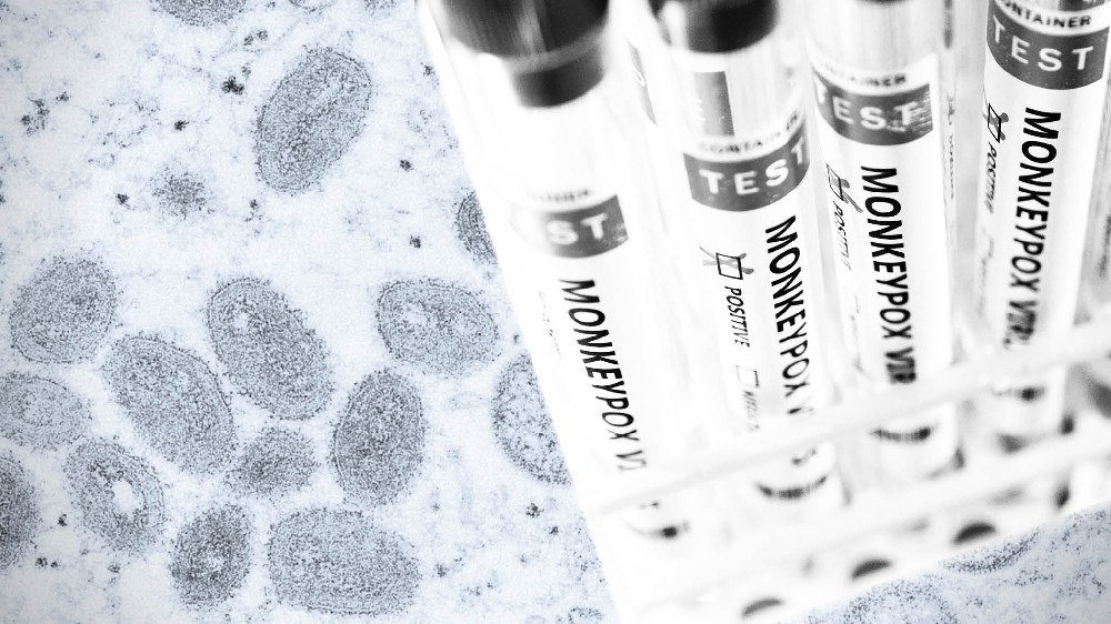 Monkeypox declared global health emergency by WHO