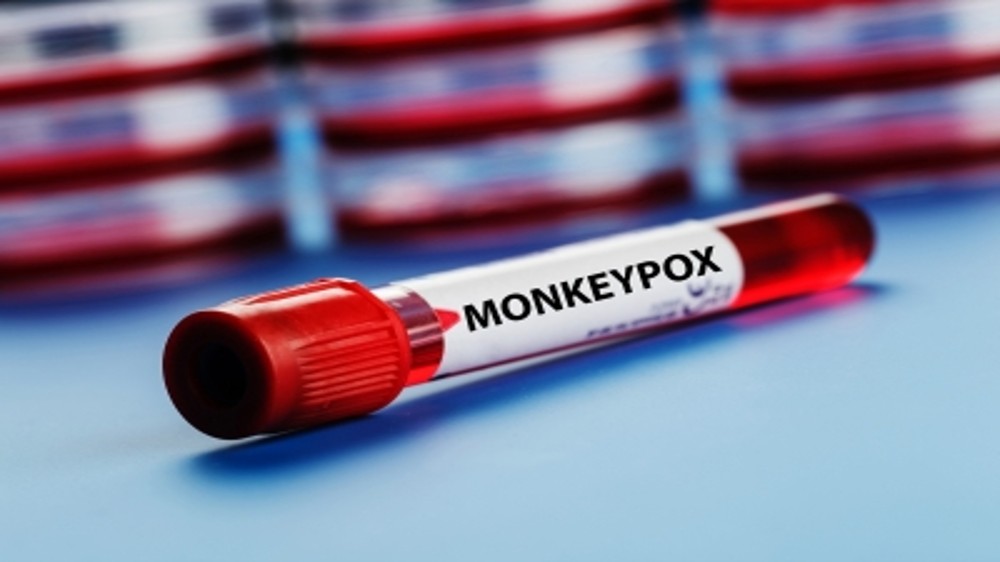 Spain confirms first monkeypox death