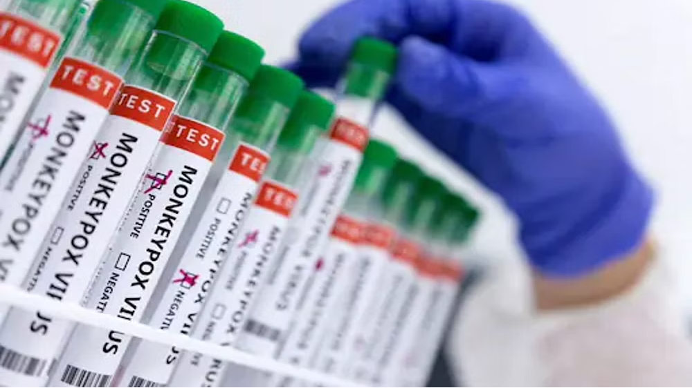 Trace infection source of Delhi monkeypox patient: Cong to govt