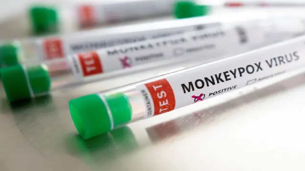 US at risk of losing control of monkeypox outbreak