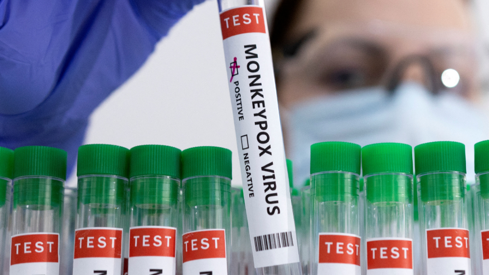 Kerala issues SOPs for treatment, isolation of Monkeypox cases