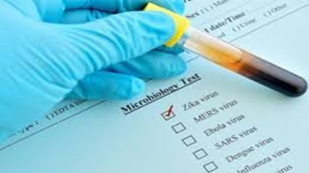 New smartphone clip-on may help detect Zika virus