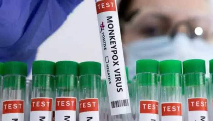 Suspected monkeypox patient in Andhra tests negative