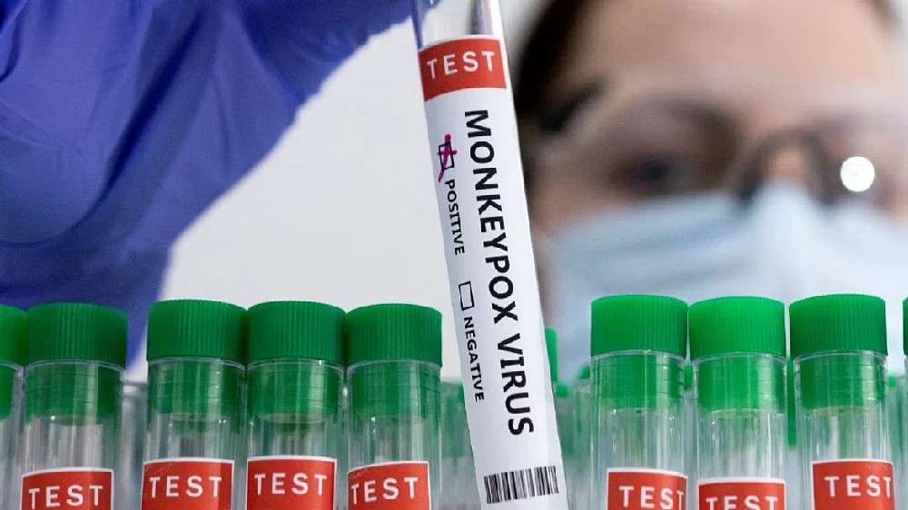 ICMR-NIV analysis finds A.2 strain of first two monkeypox cases ICMR-NIV analysis finds A.2 strain of first two monkeypox cases