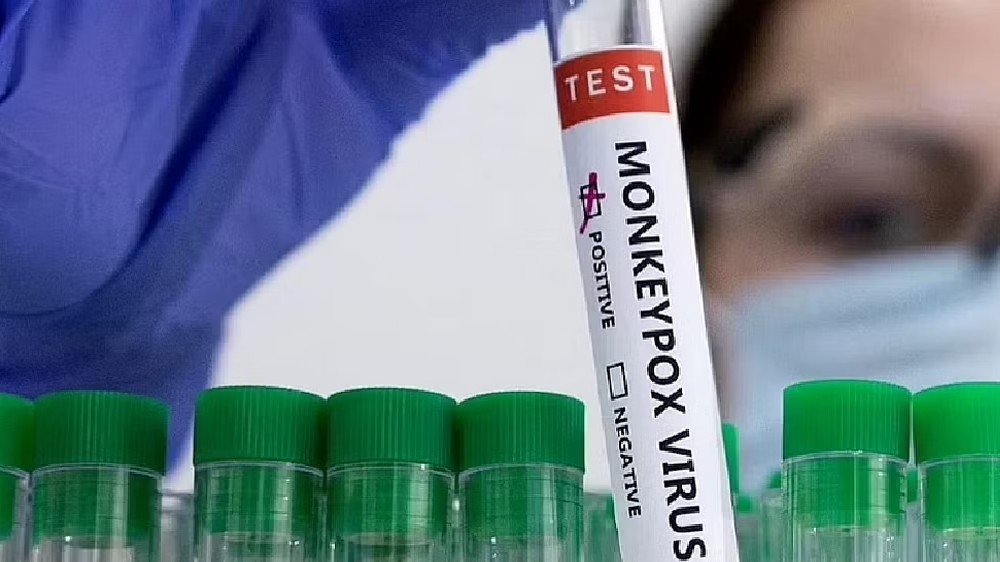 Still possible to control monkeypox outbreak: Ex-FDA chief