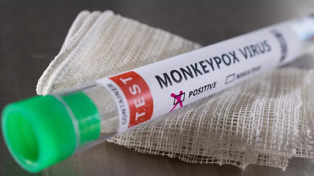 ICMR planning sero-survey among contacts of monkeypox patients