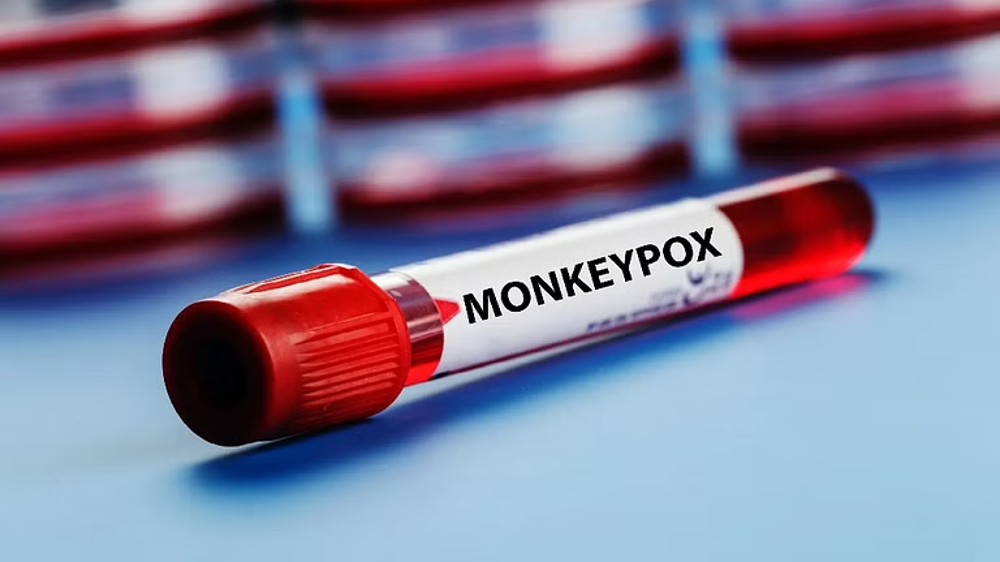 Delhi records second monkeypox case, nationwide tally reaches 6 Delhi records second monkeypox case, nationwide tally reaches 6