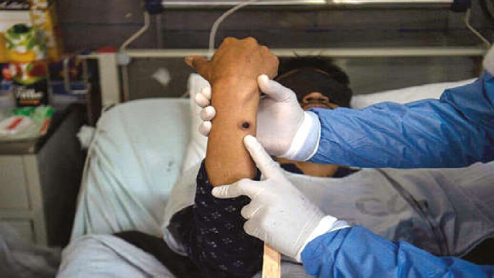 Not the monkeypox docs thought they knew Not the monkeypox docs thought they knew