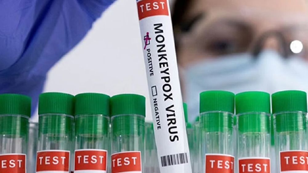 ICMR NIV Pune, VRDLs conduct approx 100 sample tests for Monkeypox