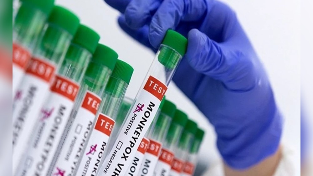 Monkeypox can become endemic: here’s how it can be stopped