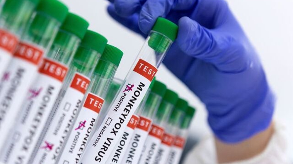 Guatemala confirms 1st case of monkeypox