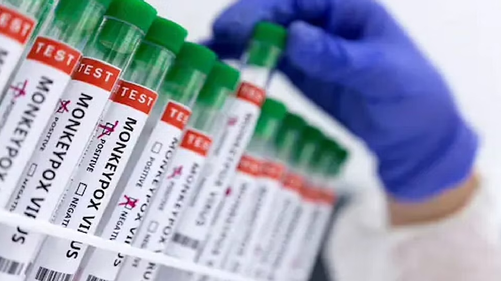 Fear of social stigma preventing Asians from monkeypox testing