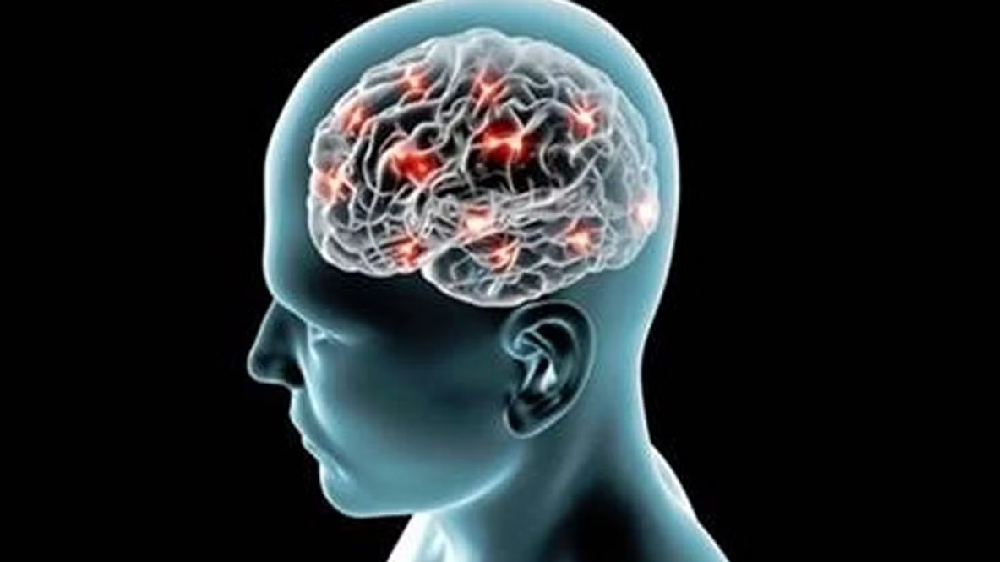 DT Health: Alzheimer onset can be delayed by early diagnosis