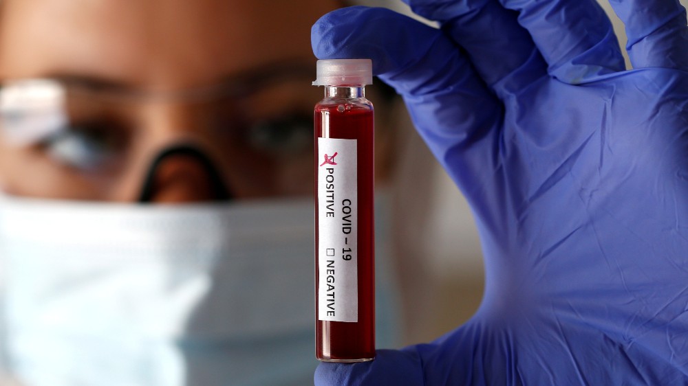 Blood test could predict people at risk of long Covid: Study