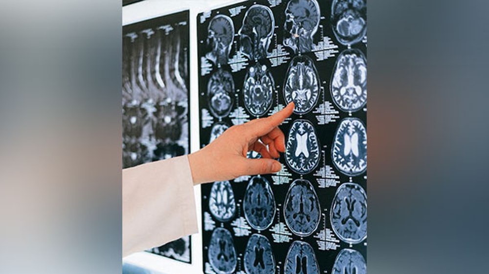 Exploring mechanisms underlying consciousness problems