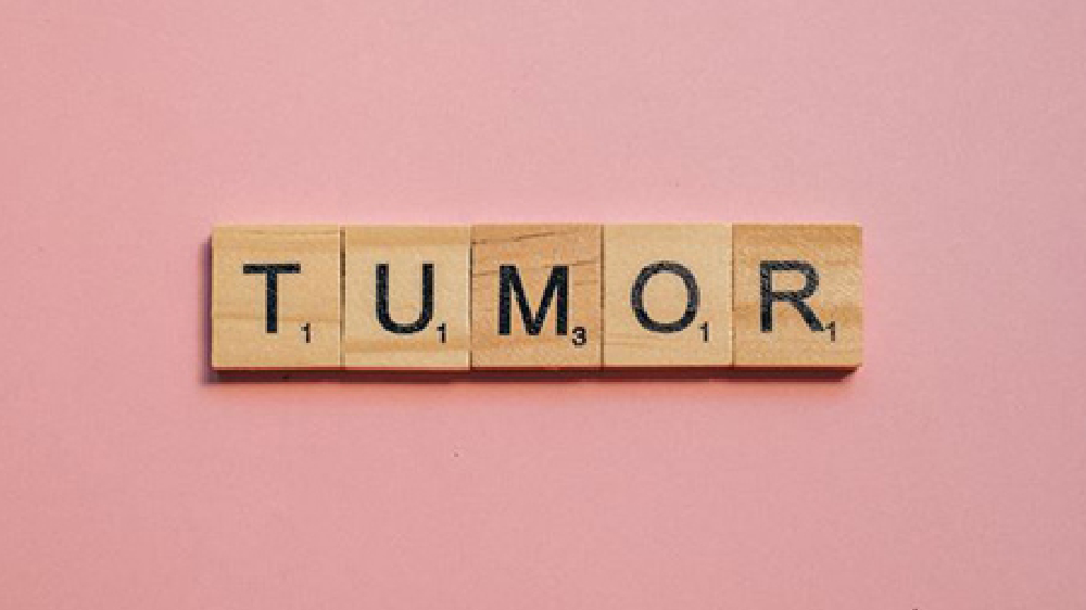 Scientists discover new device to measure changing size of tumors