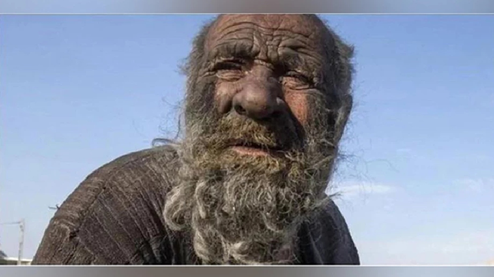 Dirtiest man Amou Haji dies after taking first bath in decades