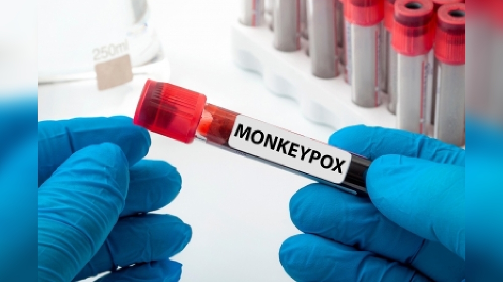 NZ confirms 1st two monkeypox cases of community transmission
