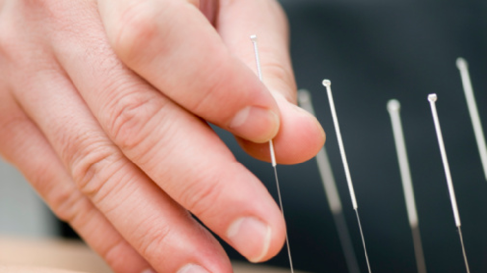 Acupuncture to manage chronic asthma