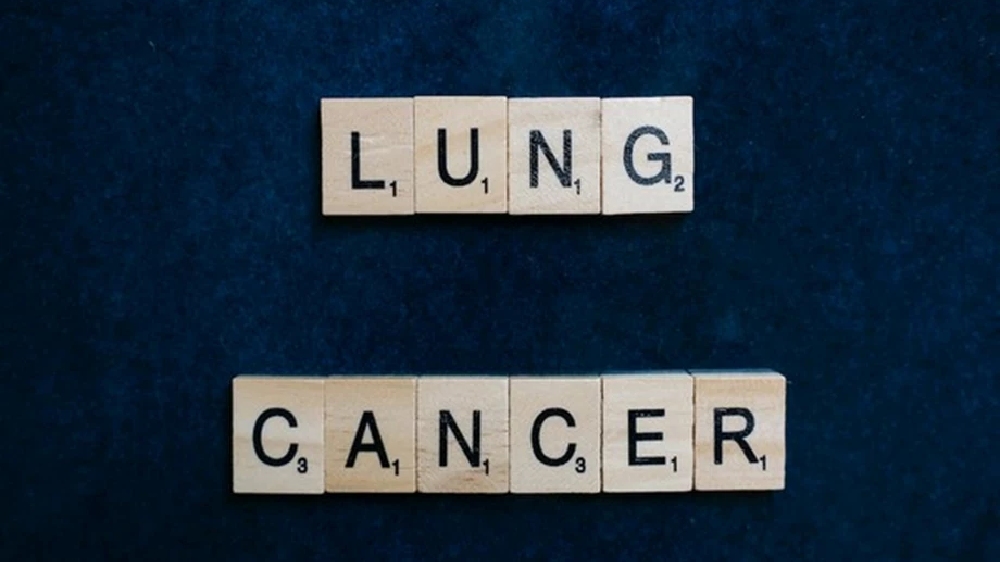 Tumour matrix profiling can predict some lung cancers progression Tumour matrix profiling can predict some lung cancers progression