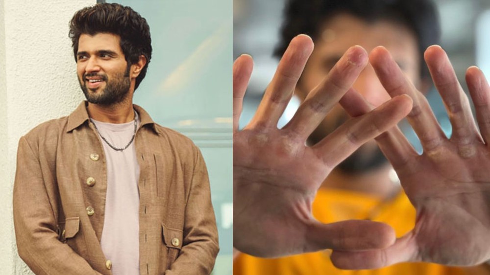 The Beast Is Dying... Vijay Deverakonda recovers from injury