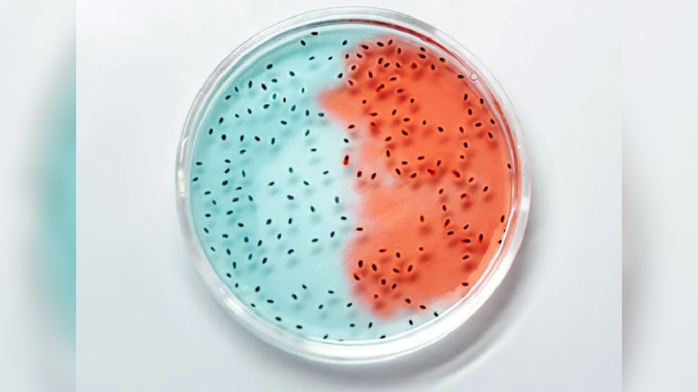 How good friendships are associated with healthier gut microbiome