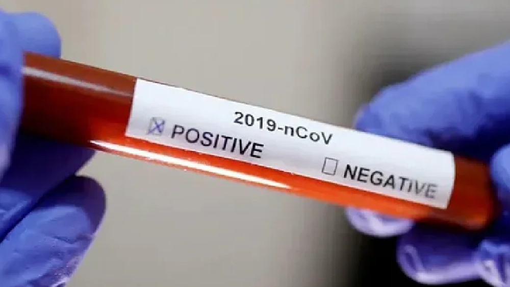 Covid can deteriorate diabetes, associated heath disease