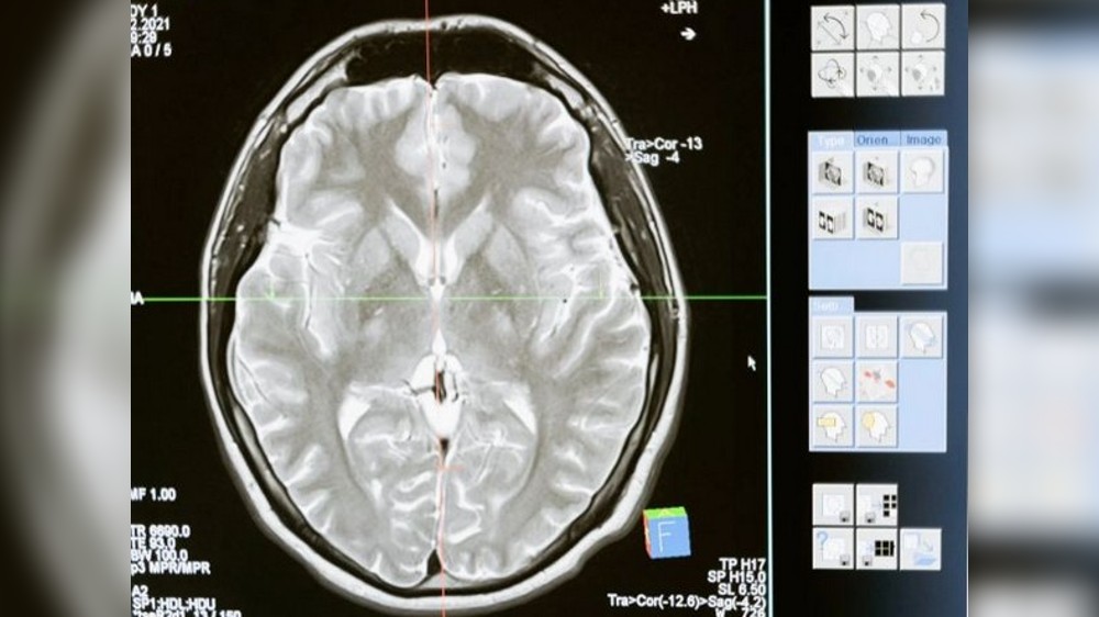 Scientists create new map of developing cerebral cortex