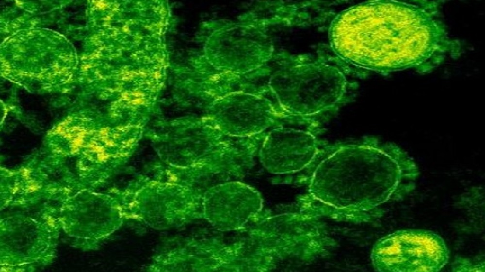 Antiviral defense regulates intestinal function, overall gut health