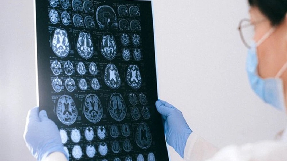 Not neurons, but synapses, form working memory, hold info: Study