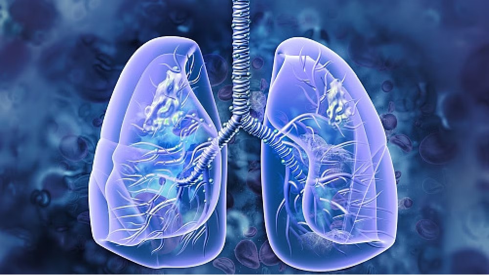 Study finds imaging agent helps to remove lung cancer tumors