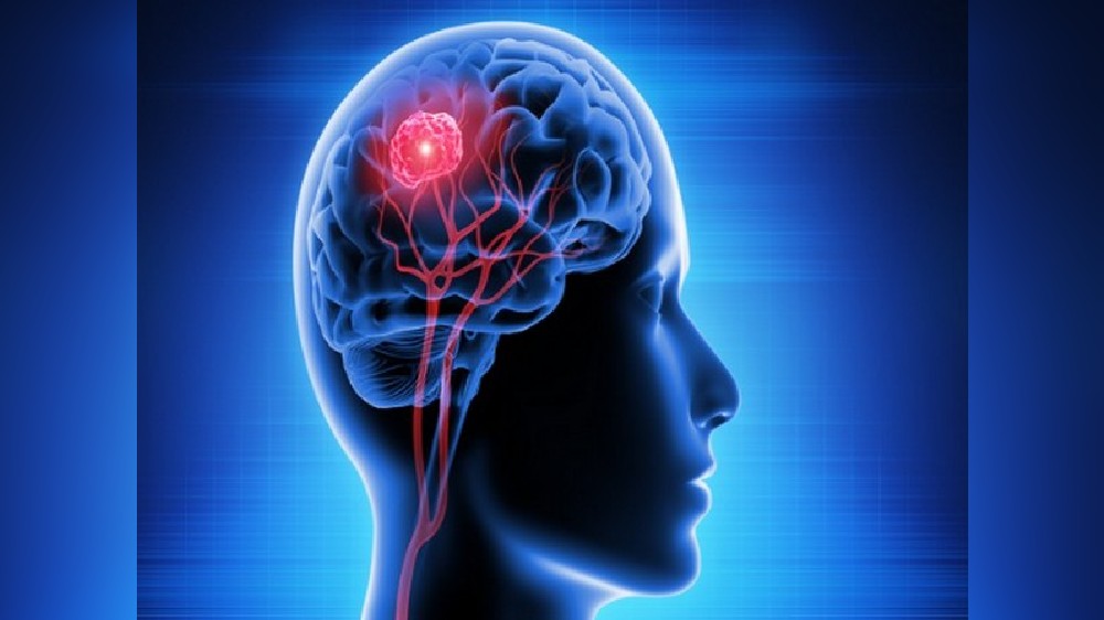 Brain game can predict risk of infection: Study