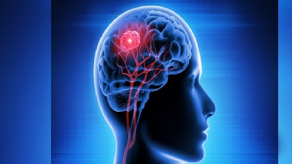 Study reveals potential cause of dementia Study reveals potential cause of dementia