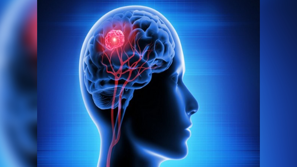 Head injury linked with doubled mortality rate in long term: Research