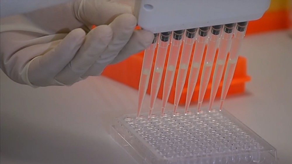 Young scientist develops biosensor that can detect Covid from sweat