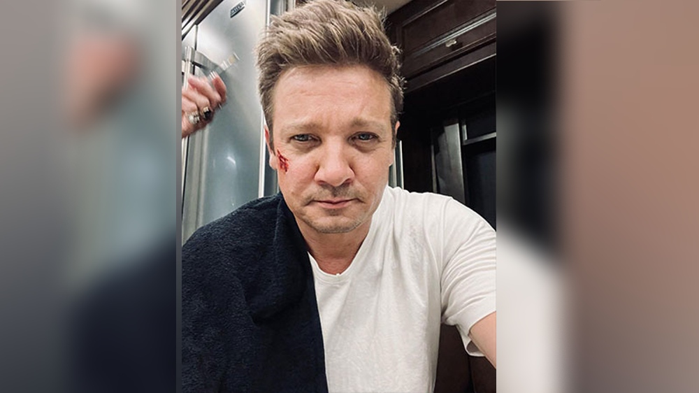 Jeremy Renner reveals he broke over 30 bones in snow plow accident