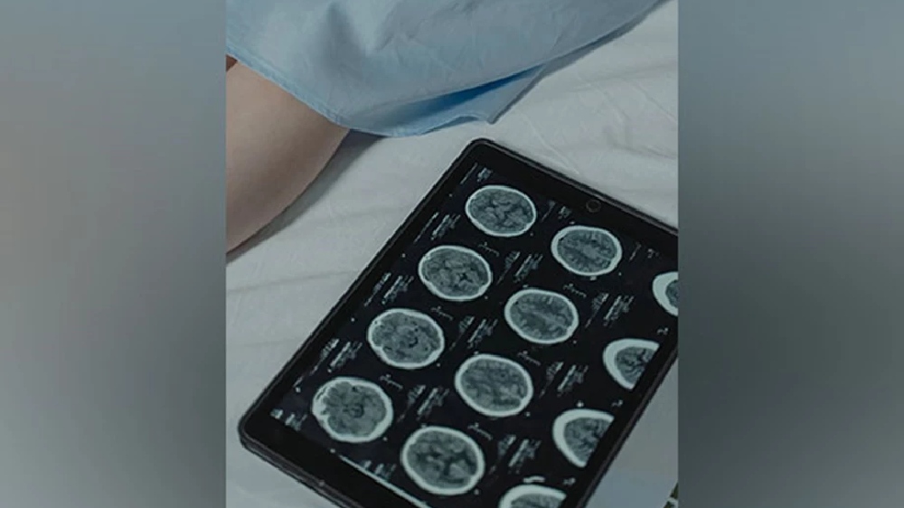 Study shows machine learning can predict development of brain tumours