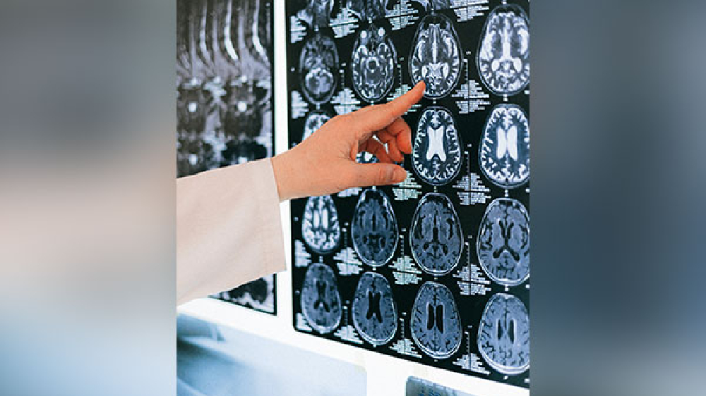 Traffic pollution affects brain function: Study