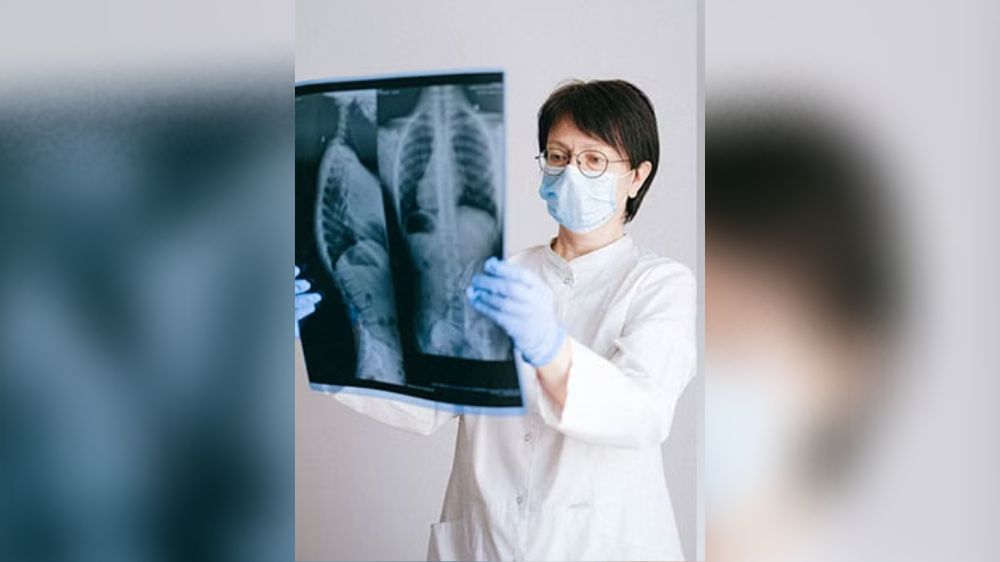 New screening tool aims to help in COPD diagnosis