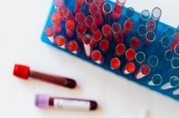 Screening tests postmenopausal women should have